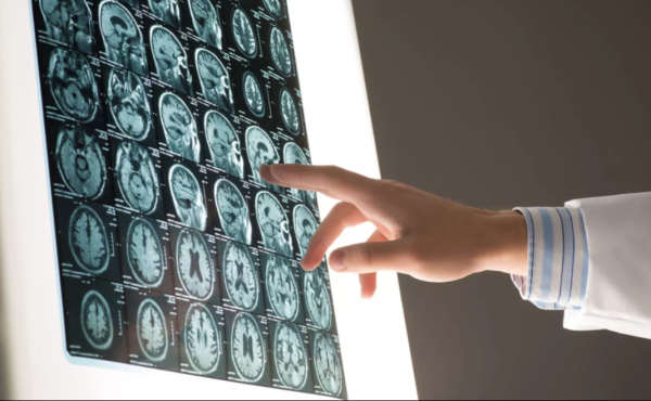 Онищенко раскрыл, когда начинает стареть мозг человека