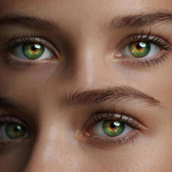 Жёлтые бляшки на веке&nbsp;&ndash; признак повышенного холестерина